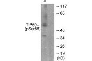 Western blot analysis of extracts from Jurkat cells, using TIP60 (Phospho-Ser86) Antibody. (KAT5 抗体  (pSer86))