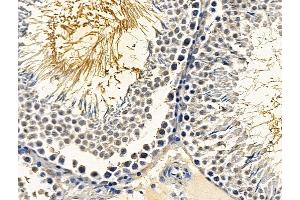 ABIN7096682 and ABIN7100747 at 1/100 staining rat testis tissue by IHC-P.