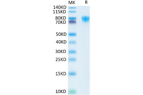 PDGFRA Protein (His-Avi Tag)