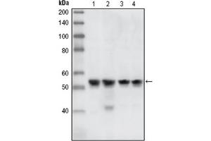 Western Blotting (WB) image for anti-Checkpoint Kinase 1 (CHEK1) antibody (ABIN1106682) (CHEK1 抗体)