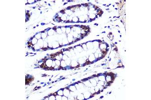 Immunohistochemistry of paraffin-embedded human colon using APIP Rabbit pAb (ABIN6131310, ABIN6136985, ABIN6136986 and ABIN6222909) at dilution of 1:100 (40x lens). (APIP 抗体  (AA 1-242))