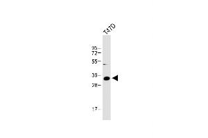 Anti-IGFBP2 Antibody (C-term) at 1:1000 dilution + T47D whole cell lysate Lysates/proteins at 20 μg per lane. (IGFBP2 抗体  (C-Term))