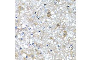 Immunohistochemistry (Paraffin-embedded Sections) (IHC (p)) image for anti-Electron-Transfer-Flavoprotein, alpha Polypeptide (ETFA) (AA 1-333) antibody (ABIN6140315)