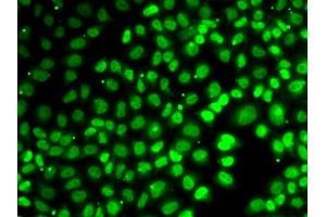 Immunofluorescence analysis of MCF7 cells using XPO5 antibody. (XPO5 抗体  (AA 925-1204))