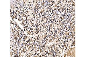 IHC analysis of HIP1R using anti-HIP1R antibody (ABIN7601290). (HIP1R 抗体  (AA 316-734))