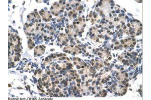 Image no. 1 for anti-ATP-Dependent RNA Helicase A (DHX9) (AA 171-220) antibody (ABIN6736602) (DHX9 抗体  (AA 171-220))