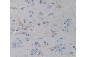 IHC-P analysis of Kidney tissue, with DAB staining. (ICAM-3/CD50 抗体  (AA 46-197))