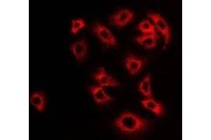 Immunofluorescent analysis of Monoamine Oxidase B staining in Hela cells. (Monoamine Oxidase B 抗体)