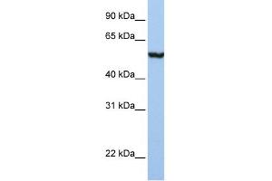 WB Suggested Anti-SLC39A5 Antibody Titration:  1 ug/ml  Positive Control:  Placenta (SLC39A5 抗体  (N-Term))