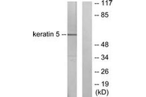 Western blot analysis of extracts from HepG2 cells, using Keratin 5 Antibody. (Cytokeratin 5 抗体  (AA 541-590))