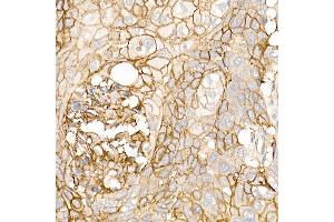 Immunohistochemistry (IHC) image for anti-S100 Calcium Binding Protein A10 (S100A10) (AA 1-97) antibody (ABIN3015804)