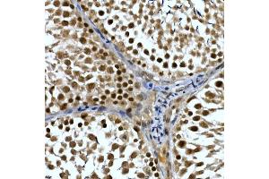 Immunohistochemistry of paraffin-embedded rat testis using NELFCD Rabbit pAb (ABIN1683024, ABIN3019182, ABIN3019183 and ABIN6220747) at dilution of 1:50 (40x lens). (TH1-Like 抗体  (AA 355-599))