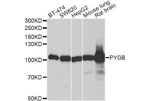 Western blot analysis of extracts of various cell lines, using PYGB antibody. (PYGB 抗体  (AA 544-843))