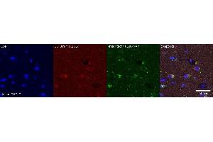 Immunohistochemistry (IHC) image for anti-PDZ and LIM Domain 5 (PDLIM5) antibody (ABIN7456073) (PDLIM5 抗体)
