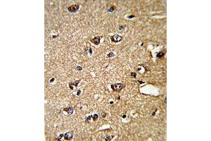 Immunohistochemistry (Paraffin-embedded Sections) (IHC (p)) image for anti-Peptidylprolyl Isomerase A (Cyclophilin A) (PPIA) (AA 8-37), (N-Term) antibody (ABIN389487)