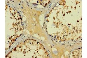 Immunohistochemistry of paraffin-embedded human testis tissue using ABIN7145137 at dilution of 1:100