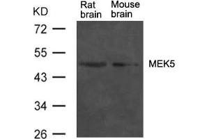 Western blot analysis of extract from rat brain and mouse brain tissue using MEK5 Antibody (MAP2K5 抗体  (AA 311-315))
