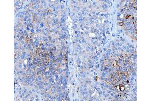 IHC analysis of Desmoglein 2/DSG2 using anti-Desmoglein 2/DSG2 antibody (ABIN7600804).