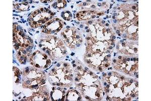 Immunohistochemical staining of paraffin-embedded Kidney tissue using anti-PPME1mouse monoclonal antibody. (PPME1 抗体)