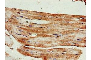 Immunohistochemistry of paraffin-embedded human skeletal muscle tissue using ABIN7157595 at dilution of 1:100 (KIF14 抗体  (AA 261-531))