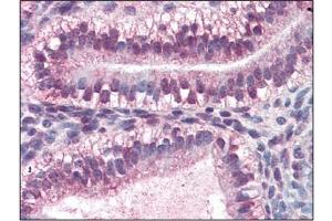 Immunohistochemistry (IHC) image for anti-Cellular Retinoic Acid Binding Protein 2 (CRABP2) (AA 1-138), (N-Term) antibody (ABIN356224) (CRABP2 抗体  (N-Term))