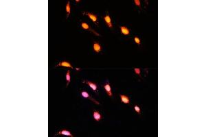 Immunofluorescence analysis of U-2 OS cells using GTF3C4 Polyclonal Antibody  at dilution of 1:100 (40x lens). (GTF3C4 抗体  (AA 583-822))