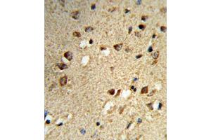 Immunohistochemistry (IHC) image for anti-Nuclear Receptor Coactivator 7 (NCOA7) antibody (ABIN3004220) (NCOA7 抗体)