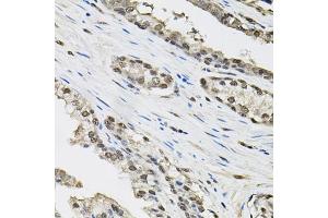 Immunohistochemistry of paraffin-embedded human prostate using TCEB1 antibody (ABIN6131624, ABIN6148930, ABIN6148932 and ABIN6219151) (40x lens). (TCEB1 抗体  (AA 1-112))