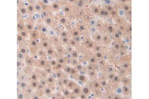 Used in DAB staining on fromalin fixed paraffin- embedded Kidney tissue (ADAM1 抗体  (AA 463-727))