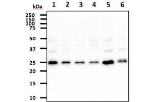The cell lysates (40ug) were resolved by SDS-PAGE, transferred to PVDF membrane and probed with anti-human REXO2 antibody (1:500). (REXO2 抗体)