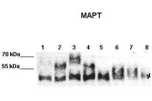 WB Suggested Anti-MAPT Antibody    Positive Control:  Lane 1: 10ug N2A expressed human Tau-C Lane 2: 10ug N2A expressed human Tau-E Lane 3: 10ug N2A expressed human Tau-F Lane 4: 10ug N2A expressed human Tau-B Lane 5: 10ug N2A expressed human Fetal-Tau Lane 6: 10ug N2A expressed human Tau-D Lane 7: 10ug N2A expressed human much Fetal-Tau Lane 8: 10ug N2A lysate   Primary Antibody Dilution :   1:2000  Secondary Antibody :  Donkey anti-rabbit-HRP   Secondry Antibody Dilution :   1:10,000   Submitted by:  Max Holzer, Paul Flechsig Institut of Brain Research, University of Leipzig (MAPT 抗体  (Middle Region))