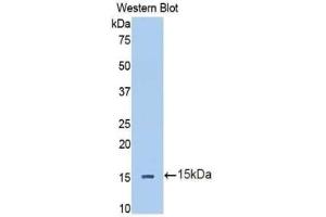 Detection of Recombinant IL13Ra2, Human using Polyclonal Antibody to Interleukin 13 Receptor Alpha 2 (IL13Ra2) (IL13RA2 抗体  (AA 238-334))