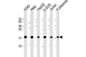 All lanes : Anti-COD1 Antibody (N-Term) at 1:2000 dilution Lane 1: A549 whole cell lysate Lane 2: Hela whole cell lysate Lane 3: HepG2 whole cell lysate Lane 4: U-2OS whole cell lysate Lane 5: Jurkat whole cell lysate Lane 6: human placenta lysate Lysates/proteins at 20 μg per lane. (COMMD1 抗体)