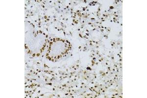 Immunohistochemistry of paraffin-embedded human stomach using SNRNP70 antibody. (SNRNP70 抗体  (AA 150-250))