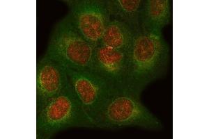 IF analysis of ONECUT1 and Tubulin beta using anti-ONECUT1 antibody (ABIN7599190) and anti-Tubulin beta antibody (ABIN7602744). (ONECUT1 抗体  (AA 1-270))
