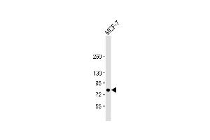 Anti-BRAF Antibody  at 1:1000 dilution + MCF-7 whole cell lysate Lysates/proteins at 20 μg per lane. (SNRPE 抗体  (AA 580-609))