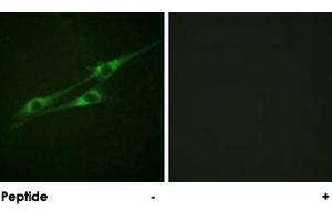 Immunofluorescence analysis of NIH/3T3 cells, using IL13RA1 polyclonal antibody . (IL13 Receptor alpha 1 抗体)