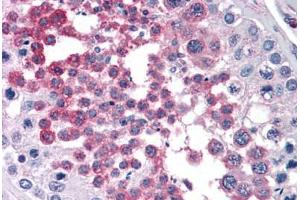 Human Testis: Formalin-Fixed, Paraffin-Embedded (FFPE) (RPS7 抗体  (AA 95-195))