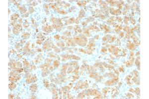 Formalin-fixed, paraffin-embedded human Pancreas stained with GP2 Recombinant Rabbit Monoclonal Antibody (GP2/2569R). (Recombinant GP2 抗体  (AA 35-179))