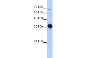 Western Blotting (WB) image for anti-ATPase, H+ Transporting, Lysosomal 38kDa, V0 Subunit D2 (ATP6V0D2) (Middle Region) antibody (ABIN2786234)