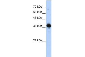WB Suggested Anti-ATP6V0D2 Antibody Titration: 0. (ATP6V0D2 抗体  (Middle Region))