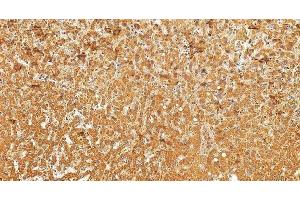 anti-Bardet-Biedl Syndrome 9 (BBS9) (AA 37-793) antibody