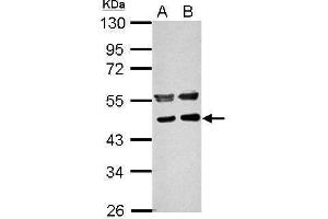 WB Image Sample (30 ug of whole cell lysate) A: NIH-3T3 B: JC 10% SDS PAGE antibody diluted at 1:1000 (PPME1 抗体)