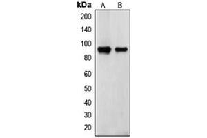 Western blot analysis of Transglutaminase 2 expression in ECV304 (A), TF1 (B) whole cell lysates. (Transglutaminase 2 抗体  (N-Term))