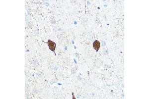Immunohistochemistry of paraffin-embedded Rat brain using Parvalbumin (Parvalbumin (PVALB)) Rabbit pAb (ABIN3016700, ABIN3016701, ABIN3016702 and ABIN6219820) at dilution of 1:100 (40x lens). (PVALB 抗体)