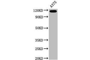 Western Blot Positive WB detected in A375 whole cell lysate All lanes CD146 antibody at 0. (Recombinant MCAM 抗体)