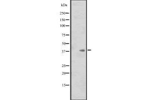 Western blot analysis of ISL1 expression in HL60 whole cell lysate ,The lane on the left is treated with the antigen-specific peptide. (ISL1 抗体  (Internal Region))
