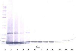 Image no. 2 for anti-Interleukin 17B (IL17B) antibody (ABIN465608)