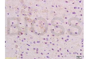 Formalin-fixed and paraffin embedded rat brain tissue labeled with Anti-ARHGAP32 Polyclonal Antibody, Unconjugated (ABIN1386112) at 1:200 followed by conjugation to the secondary antibody and DAB staining (ARHGAP32 抗体  (AA 860-896))