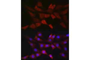 Immunofluorescence analysis of NIH/3T3 cells using PGD Rabbit mAb (ABIN7269315) at dilution of 1:100 (40x lens). (PGD 抗体)